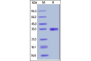 Human EGF, Mouse IgG2a Fc Tag on  under reducing (R) condition. (EGF Protein (AA 971-1023) (Fc Tag))