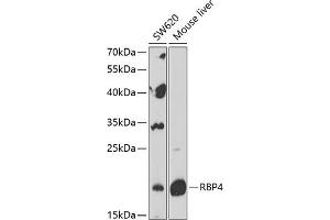 Western blot analysis of extracts of various cell lines, using RBP4 Antibody (ABIN6128555, ABIN6146803, ABIN6146804 and ABIN6216143) at 1:1000 dilution. (RBP4 antibody  (AA 19-201))