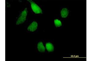 Immunofluorescence of purified MaxPab antibody to ZNF394 on HeLa cell. (ZNF394 antibody  (AA 1-561))