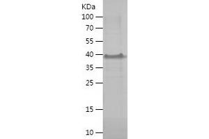 Western Blotting (WB) image for Melanoma Antigen Family A, 8 (MAGEA8) (AA 1-318) protein (His tag) (ABIN7283076) (MAGEA8 Protein (AA 1-318) (His tag))