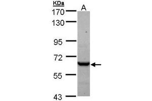 TCP1 epsilon Antibody staining of A431 (A) whole cell lysate (30 µg) at 1/1000 dilution, 7.