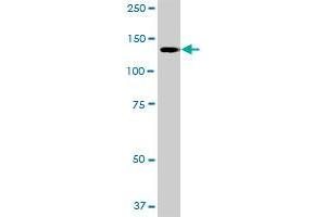 CLIP2 MaxPab polyclonal antibody. (CLIP2 antibody  (AA 1-1046))