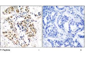 Image no. 1 for anti-Ataxia Telangiectasia Mutated (ATM) (pSer1981) antibody (ABIN196823) (ATM antibody  (pSer1981))