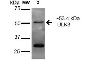 ULK3 抗体  (AA 166-177) (HRP)