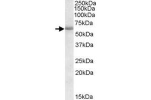 CDH23 polyclonal antibody  (1 ug/mL) staining of human amygdala lysate (35 ug protein in RIPA buffer). (CDH23 antibody)