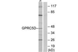 Western blot analysis of extracts from Jurkat cells, using GPRC5D Antibody. (GPRC5D antibody  (AA 271-320))