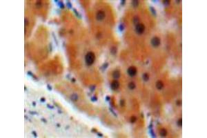 Used in DAB staining on fromalin fixed paraffin-embedded Liver tissue (C4BPA antibody  (AA 548-597))
