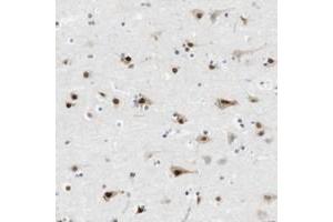 Immunohistochemical staining of human cerebral cortex with RNF38 polyclonal antibody  shows strong nuclear and moderate cytoplasmic positivity in neuronal cells. (RNF38 antibody)