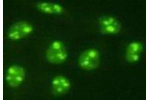 Immunocytochemistry (ICC) image for anti-PiggyBac Transposable Element Derived 5 (PGBD5) antibody (ABIN1112920)
