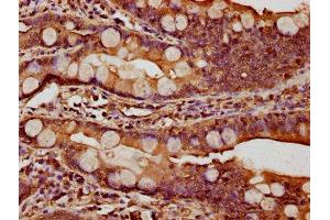 IHC image of ABIN7146972 diluted at 1:1000 and staining in paraffin-embedded human small intestine tissue performed on a Leica BondTM system. (CTNNA1 antibody  (AA 1-288))