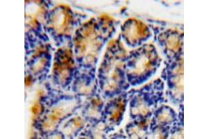 #VALUE! (ATF4 antibody  (AA 126-291))