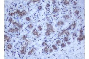 Image no. 12 for anti-DEAD (Asp-Glu-Ala-Asp) Box Polypeptide 59 (DDX59) (AA 1-303) antibody (ABIN1490728)