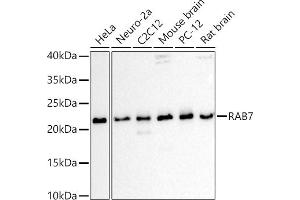 Western blot analysis of extracts of various cell lines, using R antibody (ABIN6133888, ABIN6146605, ABIN6146608 and ABIN6216535) at 1:1000 dilution.