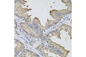 Immunohistochemistry of paraffin-embedded human prostate using IFNG antibody. (Interferon gamma antibody)