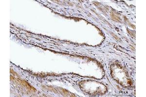 IHC analysis of BBS9 using anti-BBS9 antibody (ABIN7601518). (BBS9 antibody  (AA 37-793))
