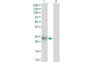 Western Blot analysis of SPRR3 expression in transfected 293T cell line by SPRR3 monoclonal antibody (M01), clone 4A12. (SPRR3 antibody  (AA 1-161))