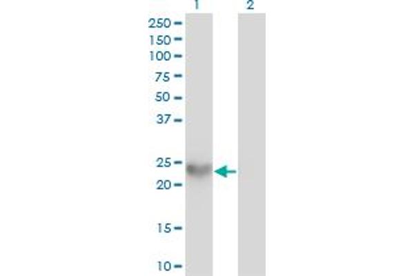 SPRR3 antibody  (AA 1-161)