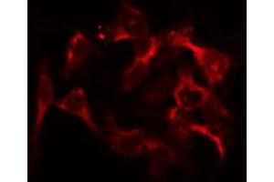 ABIN6274743 staining HeLa by IF/ICC. (MRPL46 antibody  (C-Term))