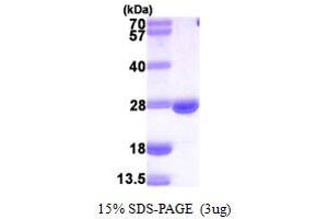 SDS-PAGE (SDS) image for Dihydrofolate Reductase (DHFR) (AA 1-187) protein (His tag) (ABIN667350)