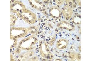 Immunohistochemistry of paraffin-embedded Human kidney using SUPT20H Polyclonal Antibody at dilution of 1:100 (40x lens). (FAM48A/P38IP antibody)