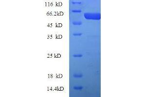 SDS-PAGE (SDS) image for Connective Tissue Growth Factor (CTGF) (AA 26-344), (partial) protein (GST tag) (ABIN5709353)