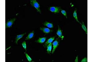 Immunofluorescent analysis of Hela cells using ABIN7163291 at dilution of 1:100 and Alexa Fluor 488-congugated AffiniPure Goat Anti-Rabbit IgG(H+L) (PIK3R4 antibody  (Regulatory Subunit 4))
