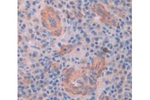 Used in DAB staining on fromalin fixed paraffin- embedded Kidney tissue (MYO5A antibody  (AA 1531-1855))