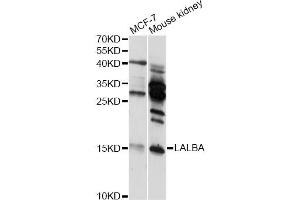 Western blot analysis of extracts of various cell lines, using LALBA antibody (ABIN6292168) at 1:3000 dilution. (LALBA antibody)