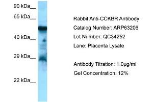Western Blotting (WB) image for anti-Cholecystokinin B Receptor (CCKBR) (C-Term) antibody (ABIN2789413) (CCKBR antibody  (C-Term))