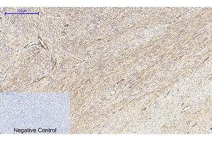 anti-Mitogen-Activated Protein Kinase Kinase 1/2 (MAP2K1/2) antibody
