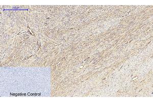 Immunohistochemical analysis of paraffin-embedded human uterus tissue. (MEK1/2 antibody)
