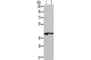 Gel: 8 % SDS-PAGE, Lysate: 40 μg, Lane 1-2: Hela cells, hepg2 cells, Primary antibody: ABIN7131237(STX16 Antibody) at dilution 1/400, Secondary antibody: Goat anti rabbit IgG at 1/8000 dilution, Exposure time: 5 seconds (Syntaxin 16 antibody)