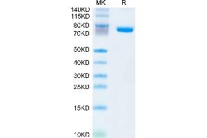 Human SEMA7A on Tris-Bis PAGE under reduced condition. (SEMA7A Protein (AA 45-648) (His tag))