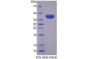 SLC25A11 Protein (AA 1-314) (His tag)