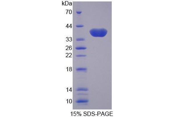 SLC25A11 Protein (AA 1-314) (His tag)