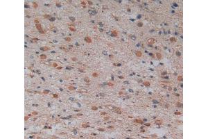 Used in DAB staining on fromalin fixed paraffin- embedded glioma tissue (GMFG antibody  (AA 6-126))