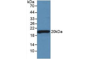 Western blot analysis of recombinant Rat SHBG. (SHBG antibody)