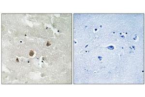 Immunohistochemical analysis of paraffin-embedded human brain tissue using MAP3K1 (Phospho-Thr1400) antibody (left)or the same antibody preincubated with blocking peptide (right). (MAP3K1 antibody  (pThr1402))