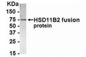 Western Blotting (WB) image for anti-Hydroxysteroid (11-Beta) Dehydrogenase 2 (HSD11B2) (AA 181-405) antibody (ABIN2468177) (HSD11B2 antibody  (AA 181-405))