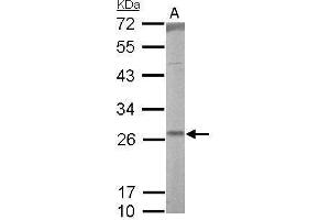 WB Image RALA antibody detects RALA protein by Western blot analysis. (rala antibody  (Center))