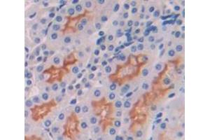 Immunohistochemistry (IHC) image for anti-Interleukin 7 Receptor (IL7R) (AA 1-239) antibody (ABIN1862791)