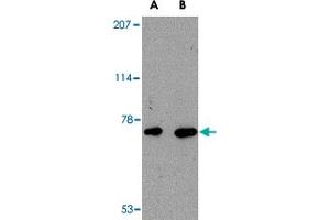 Western blot analysis of AIFM3 in human brain tissue lysate with AIFM3 polyclonal antibody  at (A) 1 and (B) 2 ug/mL . (AIFM3 antibody  (Internal Region))