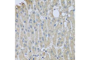 Immunohistochemistry of paraffin-embedded human liver injury using SYT11 antibody. (SYT11 antibody  (AA 37-200))