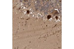 Immunohistochemical staining of human cerebellum with MLF1IP polyclonal antibody  shows strong cytoplasmic and nuclear positivity in Purkinje cells at 1:50-1:200 dilution. (MLF1IP antibody)