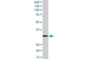ITPK1 MaxPab rabbit polyclonal antibody. (ITPK1 antibody  (AA 1-314))