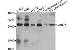 Western blot analysis of extracts of various cell lines, using VENTX antibody (ABIN4905595) at 1:1000 dilution.