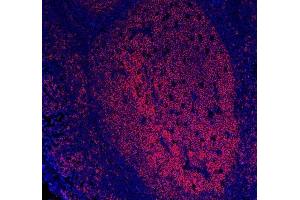 IF analysis of CD20/MS4A1 using anti-CD20/MS4A1 antibody (ABIN7599234). (CD20 antibody  (AA 1-297))