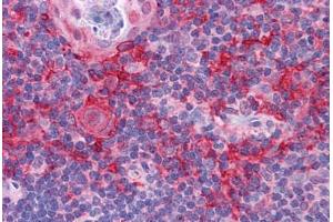 Human Thymus: Formalin-Fixed, Paraffin-Embedded (FFPE) (KLHL25 antibody  (Internal Region))