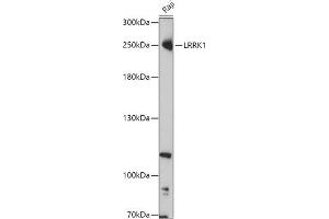 Western blot analysis of extracts of Raji cells, using LRRK1 antibody (ABIN7268231) at 1:1000 dilution. (LRRK1 antibody  (AA 10-90))
