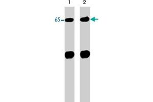 Western blot analysis of control (lane 1) and alkaline phosphatase-treated (AP) (lane 2) neonatal rat brain lysate (20 ug/lane). (Neural Wiskott-Aldrich syndrome protein (WASL) (N-Term) antibody)
